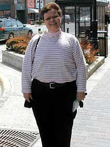 
Karen Thompson has gone through more than a dozen corrective surgeries since her first gastric bypass in 1995. Despite her problems, Thompson lost 224 pounds since then.  (MPR Photo/Tom Robertson)
