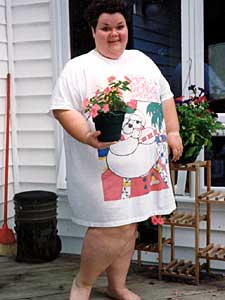 
This photo of Karen Thompson was taken just before her surgery in 1995, when she weighed about 400 pounds. Thompson suffered severe complications from the surgery and nearly died. (Submitted photo)