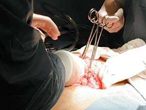 
Dr. Daniel Smith and his medical team perform Hocking's RGB bypass surgery, which is known as a malabsorptive operation. They restrict both food intake and the amount of calories and nutrients the body absorbs.  (MPR Photo/Tom Robertson)