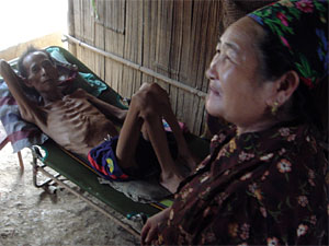 
Twenty-eight people in the camp have been diagnosed with active tuberculosis, including this man. They are now being treated for the disease.     (Photo courtesy of Dr. Patricia Walker)