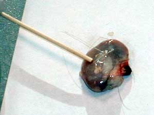 
This is what a deer lymph node destined for testing looks like.  Researchers believe that CWD's trademark prions can found in the animal's  lymph nodes it has the disease. (MPR Photo/Erin Galbally)