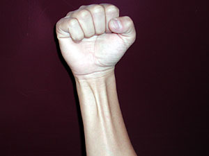 
Dr. Jobe used Tommy John's Palmaris Longus tendon in John's right forearm and wrist, and put it in John's left elbow.  In this picture, you see MPR's Eugene Cha's right wrist with two tendons showing prominently.  The Palmaris Longus tendon is the one on the right. (MPR Photo/ Tom Crann)