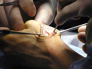 
Surgeons at St. Joseph's Hospital follow a strict set of guidelines to make sure they are operating on the correct body part. (MPR Photo/Lorna Benson)